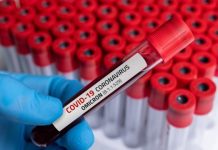 Chuyên gia Nhật Bản kêu gọi sự sẵn sàng cho biến thể Omicron